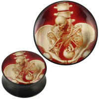 Cargar imagen en el visor de la galería, Plug Acryl Skelette schwanger Bauch Zwillinge schwarz Piercing Ohrschmuck - chic-net.de

